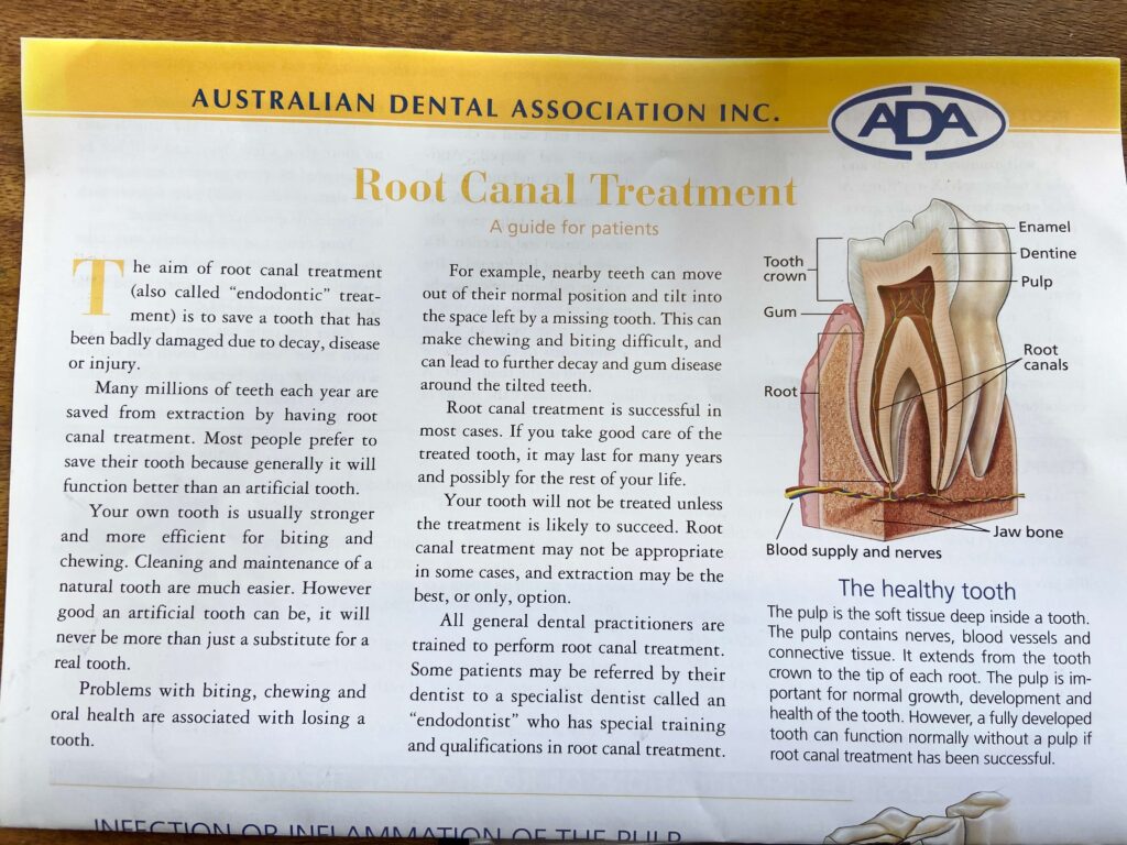 rood canal treatment